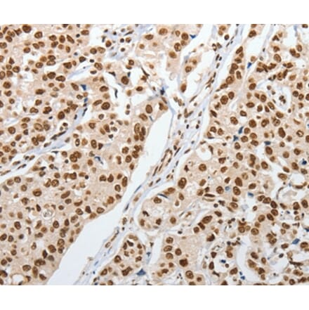 Immunohistochemistry - PIWIL3 Antibody from Signalway Antibody (37360) - Antibodies.com