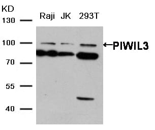 Gel: 6%SDS-PAGE Lysate: Raji, JK and 293T cell Primary antibody: 1/200 dilution Secondary antibody dilution: 1/8000 Exposure time: 2 minutes