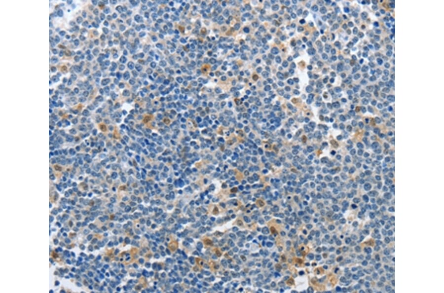 Immunohistochemistry - PIK3R2 Antibody from Signalway Antibody (37372) - Antibodies.com