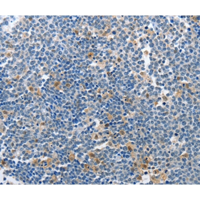 Immunohistochemistry - PIK3R2 Antibody from Signalway Antibody (37372) - Antibodies.com