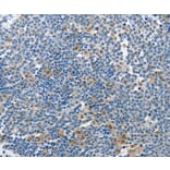 Immunohistochemistry - PIK3R2 Antibody from Signalway Antibody (37372) - Antibodies.com