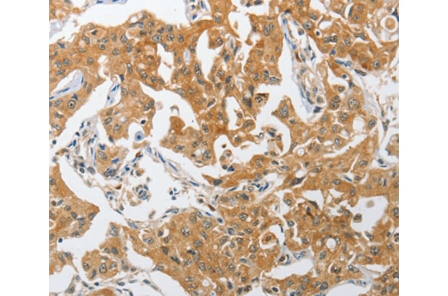 Immunohistochemistry - PIK3R3 Antibody from Signalway Antibody (37373) - Antibodies.com