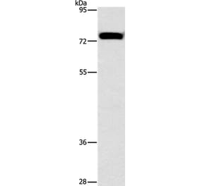 ALOX15 Antibody from Signalway Antibody (37409) - Antibodies.com