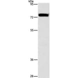 ALOX15 Antibody from Signalway Antibody (37409) - Antibodies.com