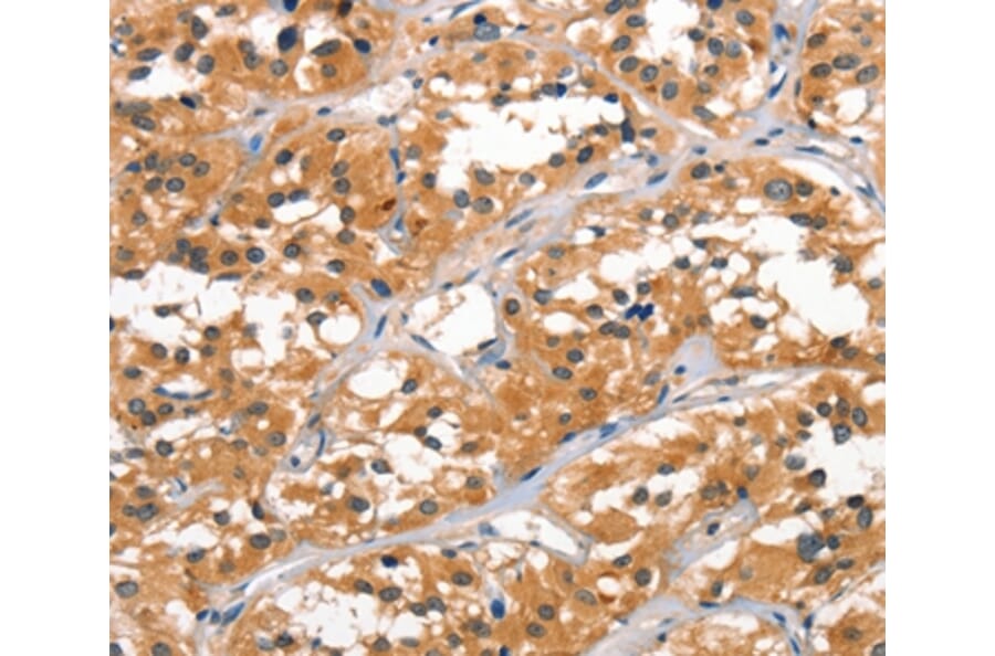 Immunohistochemistry - ALOX15 Antibody from Signalway Antibody (37409) - Antibodies.com