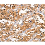 Immunohistochemistry - ALOX15 Antibody from Signalway Antibody (37409) - Antibodies.com