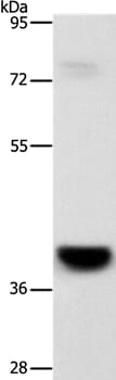 Gel: 8% SDS-PAGE Lysates (from left to right): Mouse liver tissue Amount of lysate: 40ug per lane Primary antibody: 1/1000 dilution Secondary antibody dilution: 1/8000 Exposure time: 8 minutes