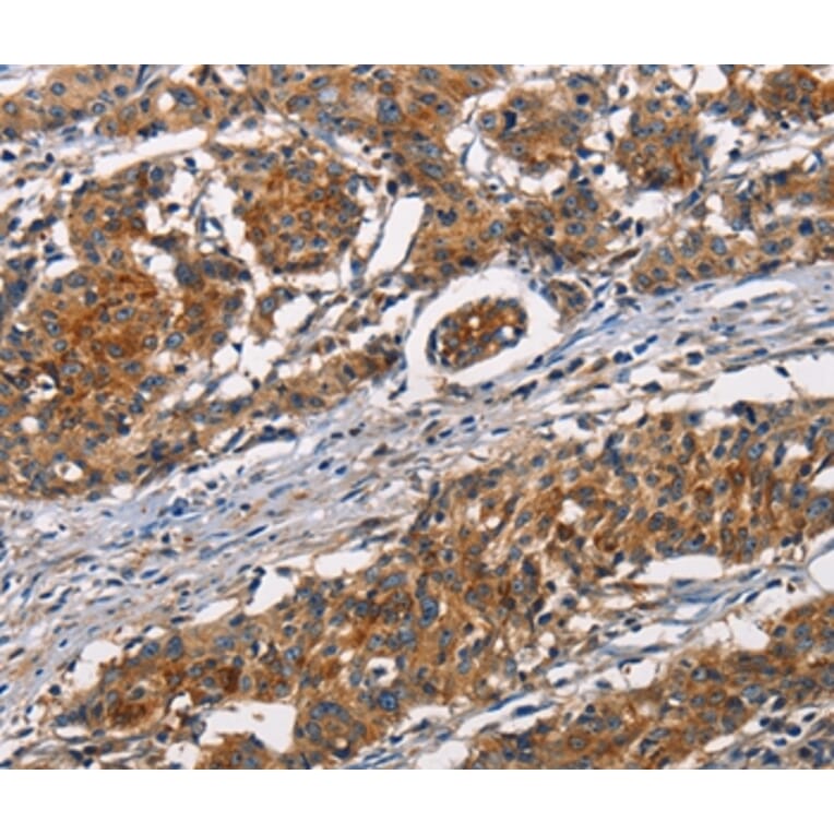 Immunohistochemistry - ATP7A Antibody from Signalway Antibody (37432) - Antibodies.com