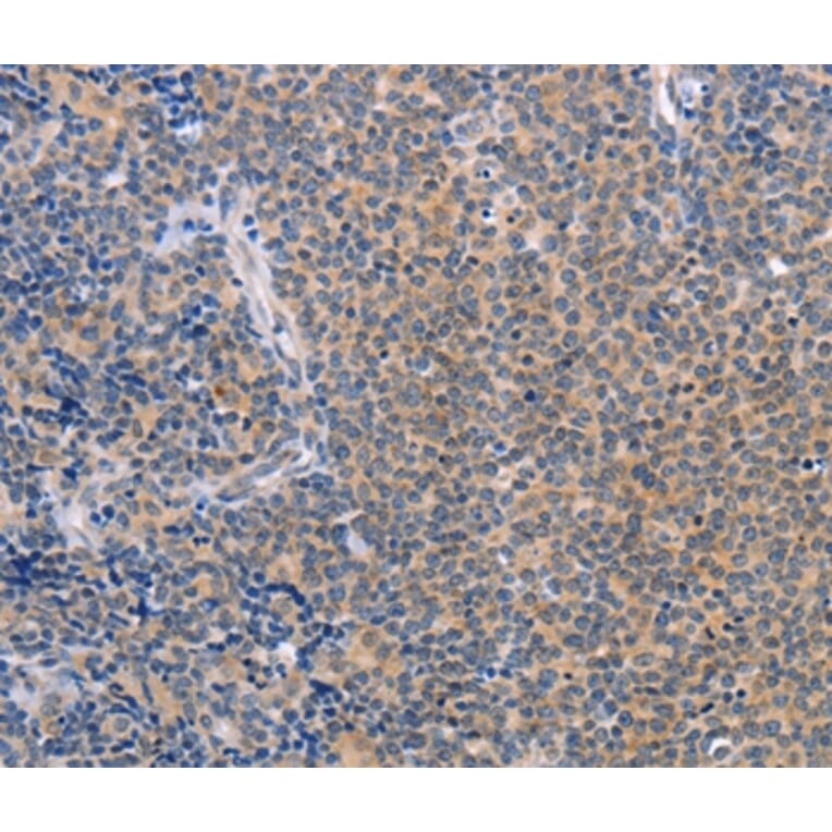 Immunohistochemistry - CCL16 Antibody from Signalway Antibody (37464) - Antibodies.com