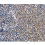 Immunohistochemistry - CCL16 Antibody from Signalway Antibody (37464) - Antibodies.com