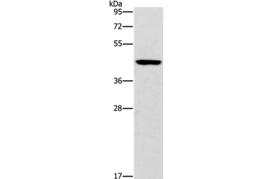B3GAT1 Antibody from Signalway Antibody (37477) - Antibodies.com