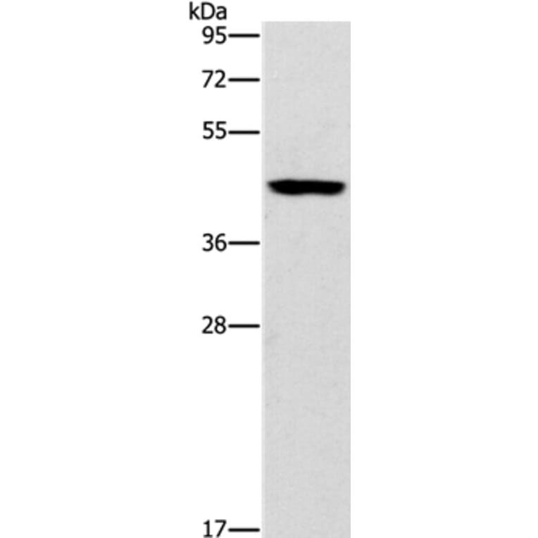B3GAT1 Antibody from Signalway Antibody (37477) - Antibodies.com