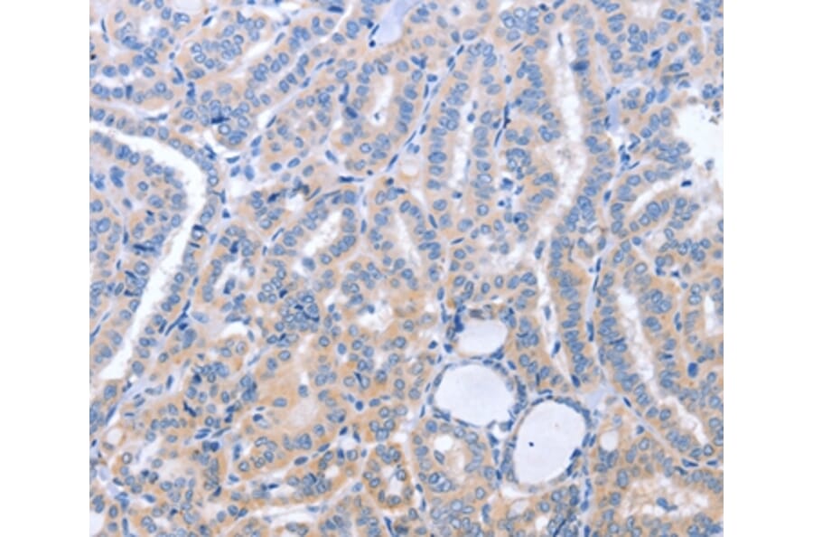 Immunohistochemistry - B3GAT1 Antibody from Signalway Antibody (37477) - Antibodies.com
