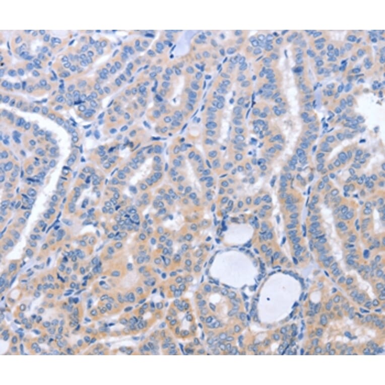 Immunohistochemistry - B3GAT1 Antibody from Signalway Antibody (37477) - Antibodies.com