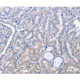 Immunohistochemistry - B3GAT1 Antibody from Signalway Antibody (37477) - Antibodies.com