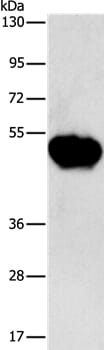 Gel: 8% SDS-PAGE Lysates (from left to right): Human fetal brain tissue Amount of lysate: 40ug per lane Primary antibody: 1/600 dilution Secondary antibody dilution: 1/8000 Exposure time: 1 minute