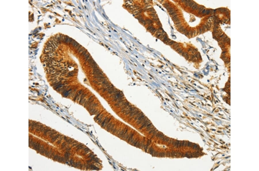 Immunohistochemistry - CHRDL2 Antibody from Signalway Antibody (37486) - Antibodies.com