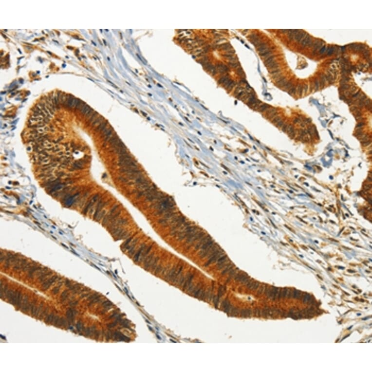 Immunohistochemistry - CHRDL2 Antibody from Signalway Antibody (37486) - Antibodies.com
