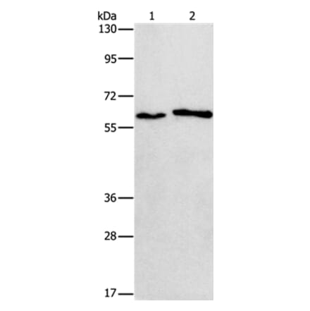 CHRNA2 Antibody from Signalway Antibody (37487) - Antibodies.com