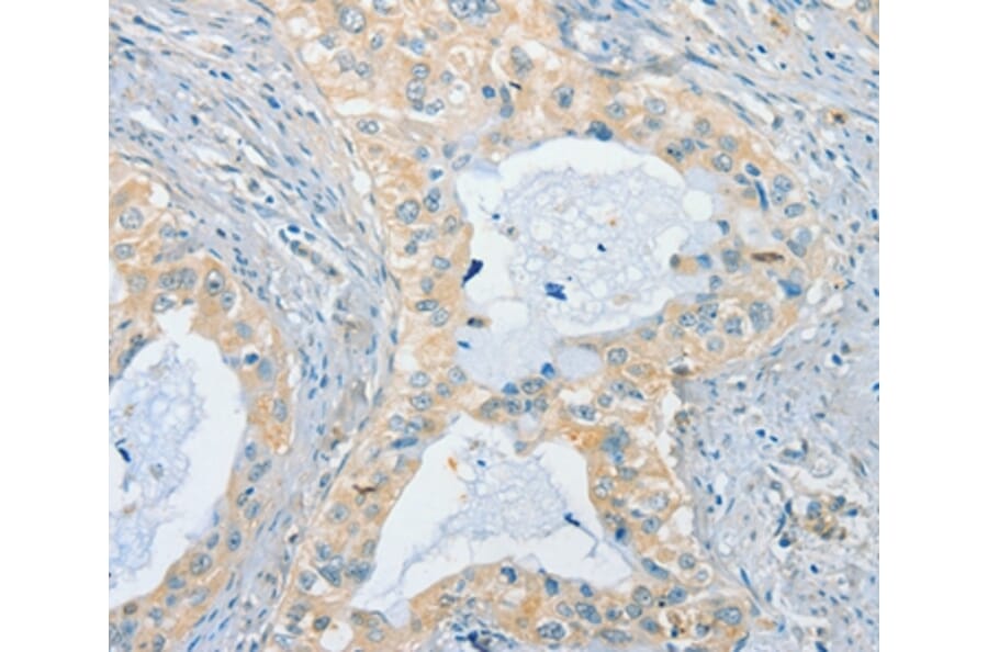 Immunohistochemistry - CHRNA2 Antibody from Signalway Antibody (37487) - Antibodies.com