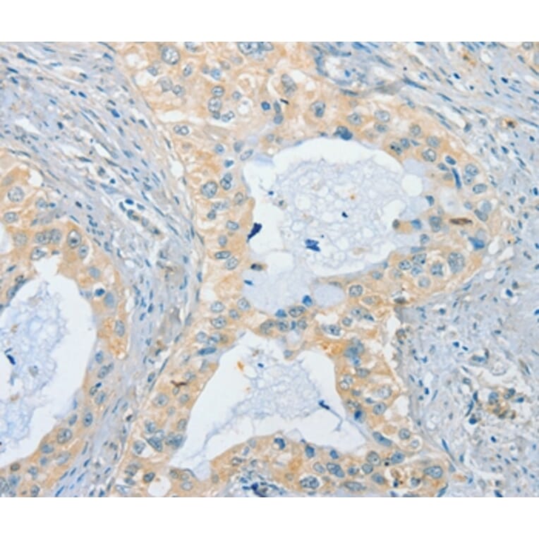 Immunohistochemistry - CHRNA2 Antibody from Signalway Antibody (37487) - Antibodies.com