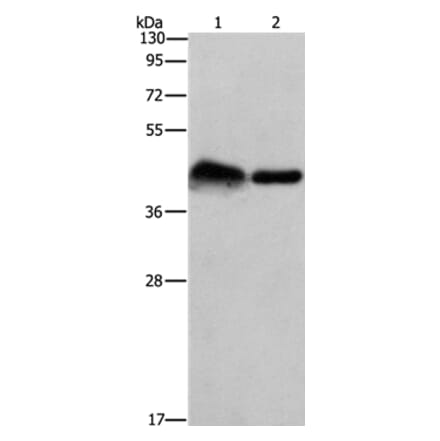 CRELD1 Antibody from Signalway Antibody (37502) - Antibodies.com