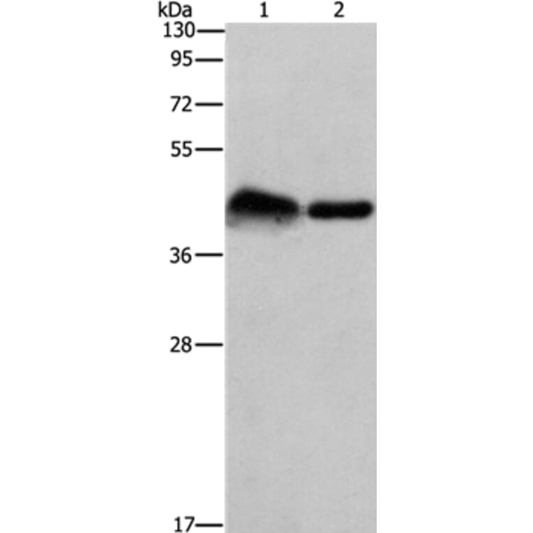 CRELD1 Antibody from Signalway Antibody (37502) - Antibodies.com