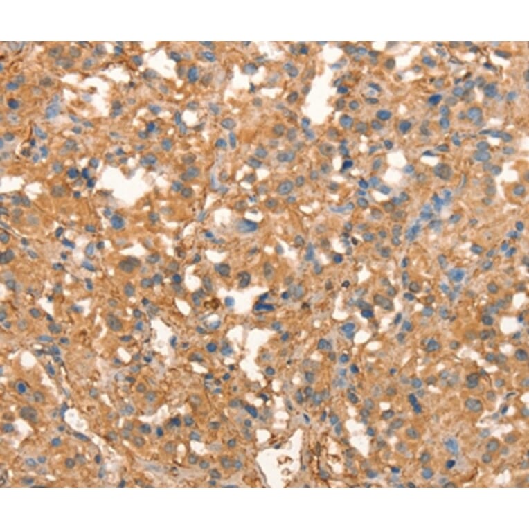 Immunohistochemistry - CRELD1 Antibody from Signalway Antibody (37502) - Antibodies.com