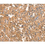 Immunohistochemistry - CRELD1 Antibody from Signalway Antibody (37502) - Antibodies.com