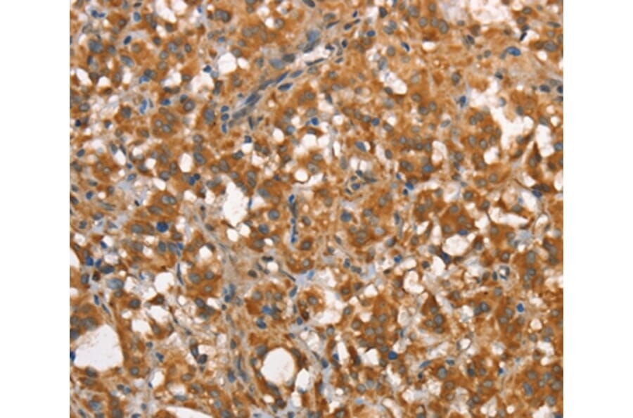Immunohistochemistry - CALCRL Antibody from Signalway Antibody (37509) - Antibodies.com
