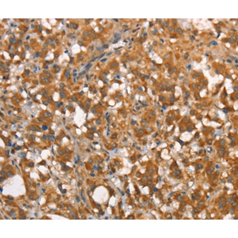 Immunohistochemistry - CALCRL Antibody from Signalway Antibody (37509) - Antibodies.com