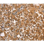 Immunohistochemistry - CALCRL Antibody from Signalway Antibody (37509) - Antibodies.com