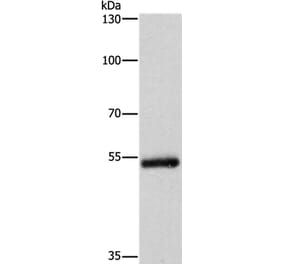 CYP2B6 Antibody from Signalway Antibody (37518) - Antibodies.com