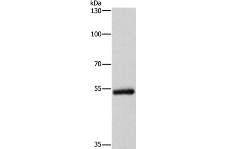 CYP2B6 Antibody from Signalway Antibody (37518) - Antibodies.com