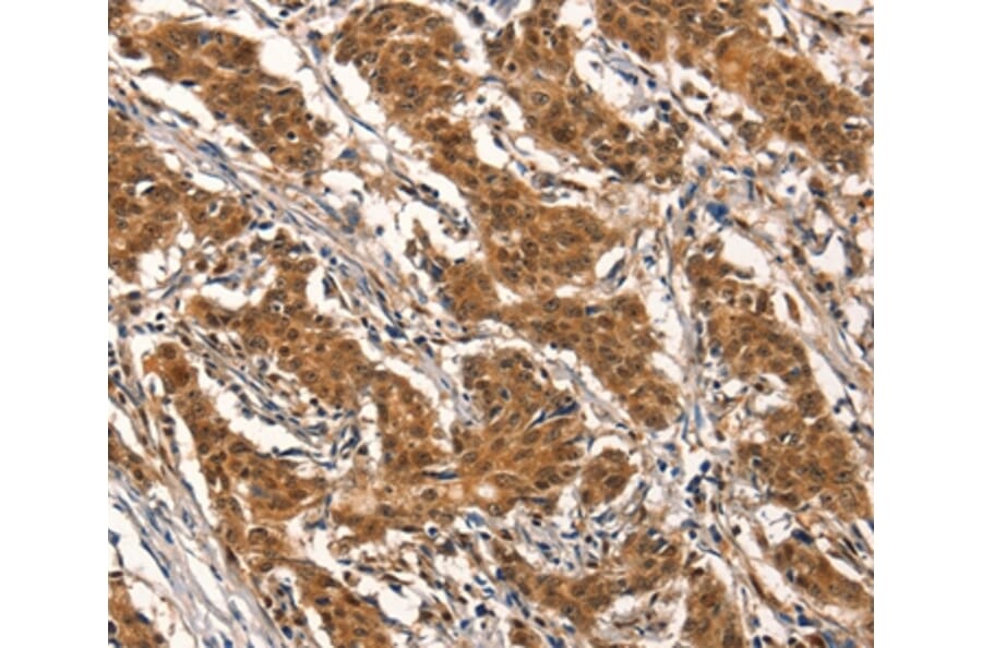 Immunohistochemistry - CYP2B6 Antibody from Signalway Antibody (37518) - Antibodies.com