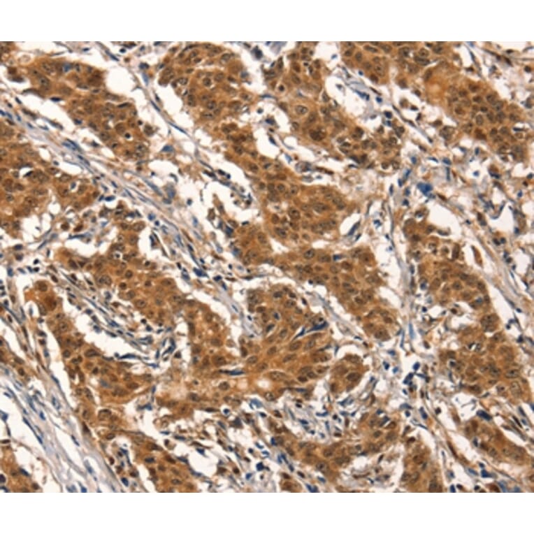 Immunohistochemistry - CYP2B6 Antibody from Signalway Antibody (37518) - Antibodies.com