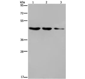 ELOVL6 Antibody from Signalway Antibody (37545) - Antibodies.com