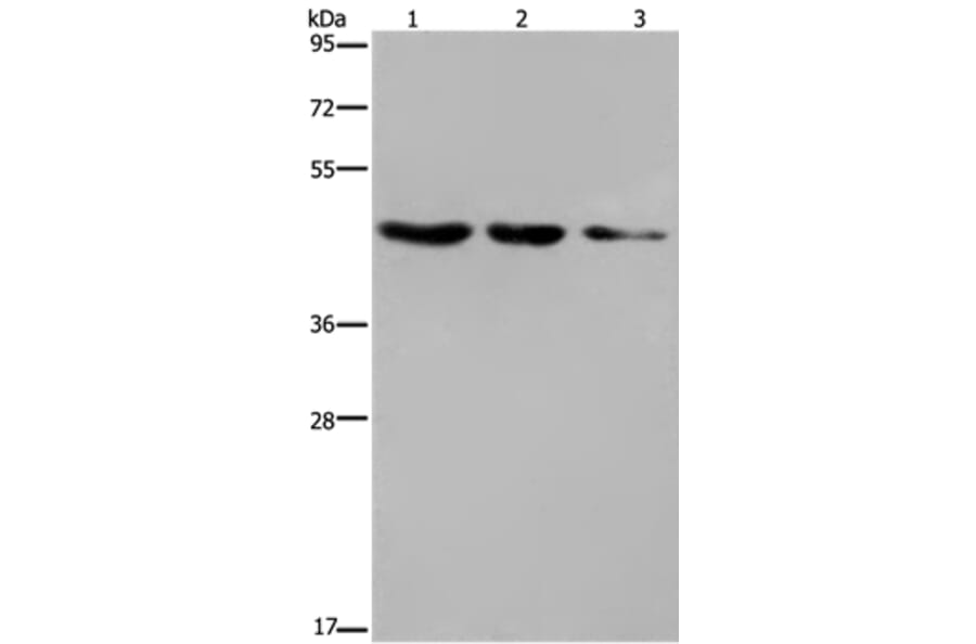 ELOVL6 Antibody from Signalway Antibody (37545) - Antibodies.com