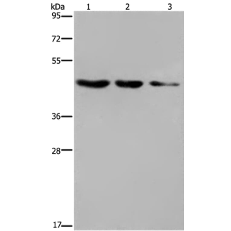 ELOVL6 Antibody from Signalway Antibody (37545) - Antibodies.com