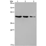 ELOVL6 Antibody from Signalway Antibody (37545) - Antibodies.com