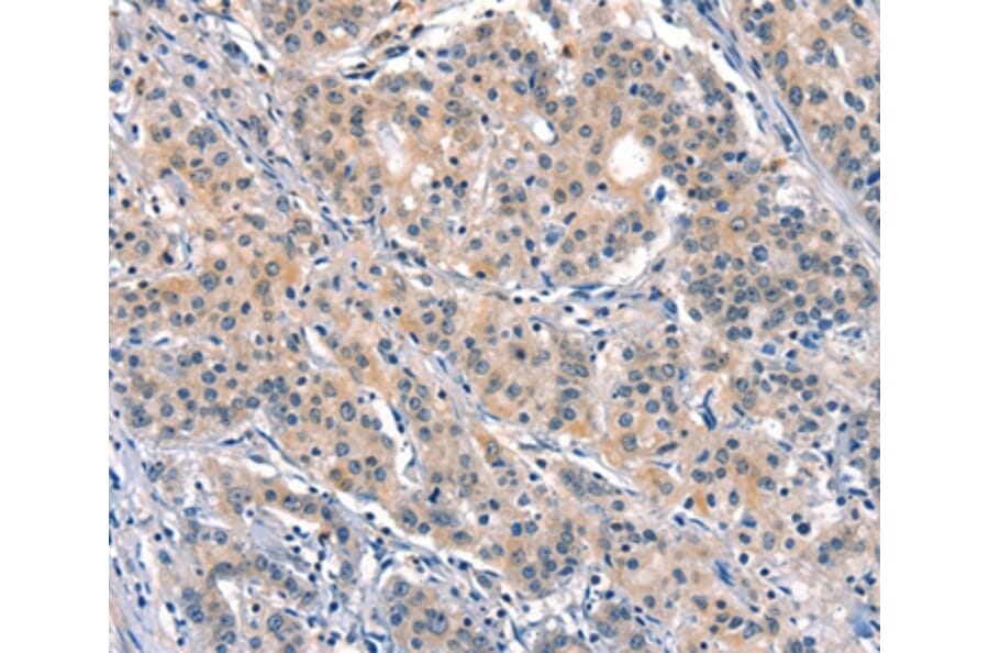Immunohistochemistry - ELOVL6 Antibody from Signalway Antibody (37545) - Antibodies.com