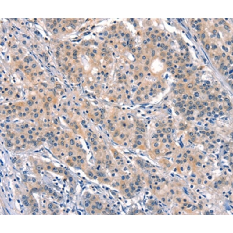 Immunohistochemistry - ELOVL6 Antibody from Signalway Antibody (37545) - Antibodies.com
