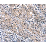 Immunohistochemistry - ELOVL6 Antibody from Signalway Antibody (37545) - Antibodies.com