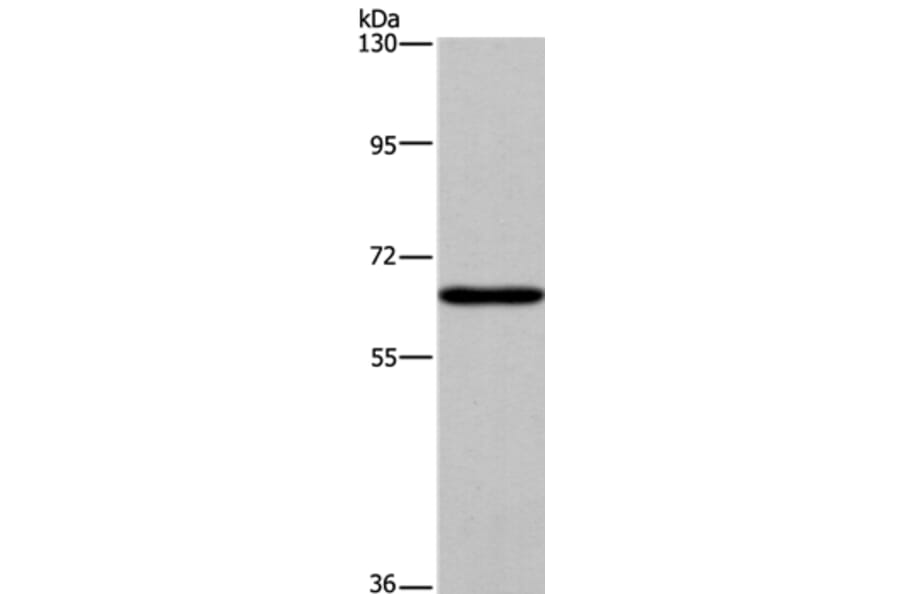 SLC6A1 Antibody from Signalway Antibody (37581) - Antibodies.com