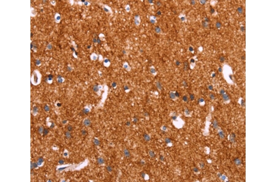 Immunohistochemistry - SLC6A1 Antibody from Signalway Antibody (37581) - Antibodies.com