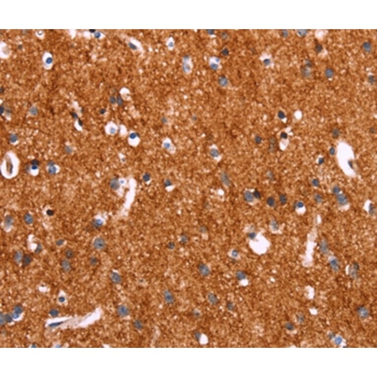 Immunohistochemistry - SLC6A1 Antibody from Signalway Antibody (37581) - Antibodies.com