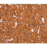 Immunohistochemistry - SLC6A1 Antibody from Signalway Antibody (37581) - Antibodies.com