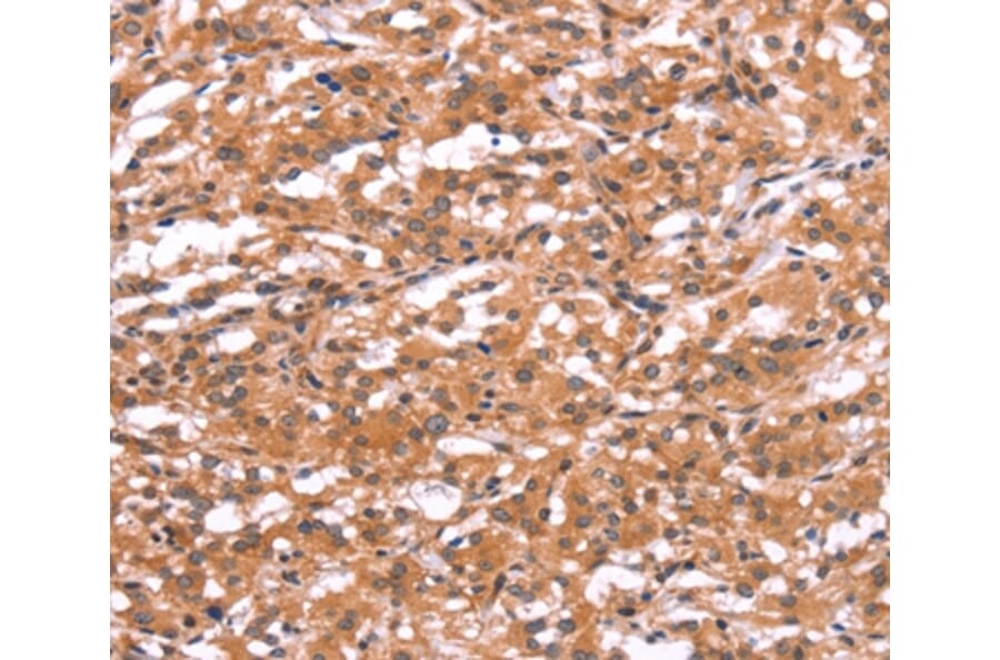 Immunohistochemistry - GABRA1 Antibody from Signalway Antibody (37583) - Antibodies.com