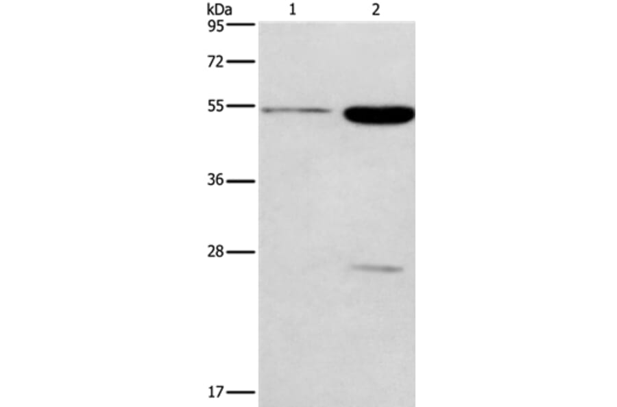 GABRG2 Antibody from Signalway Antibody (37584) - Antibodies.com