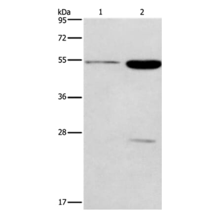 GABRG2 Antibody from Signalway Antibody (37584) - Antibodies.com